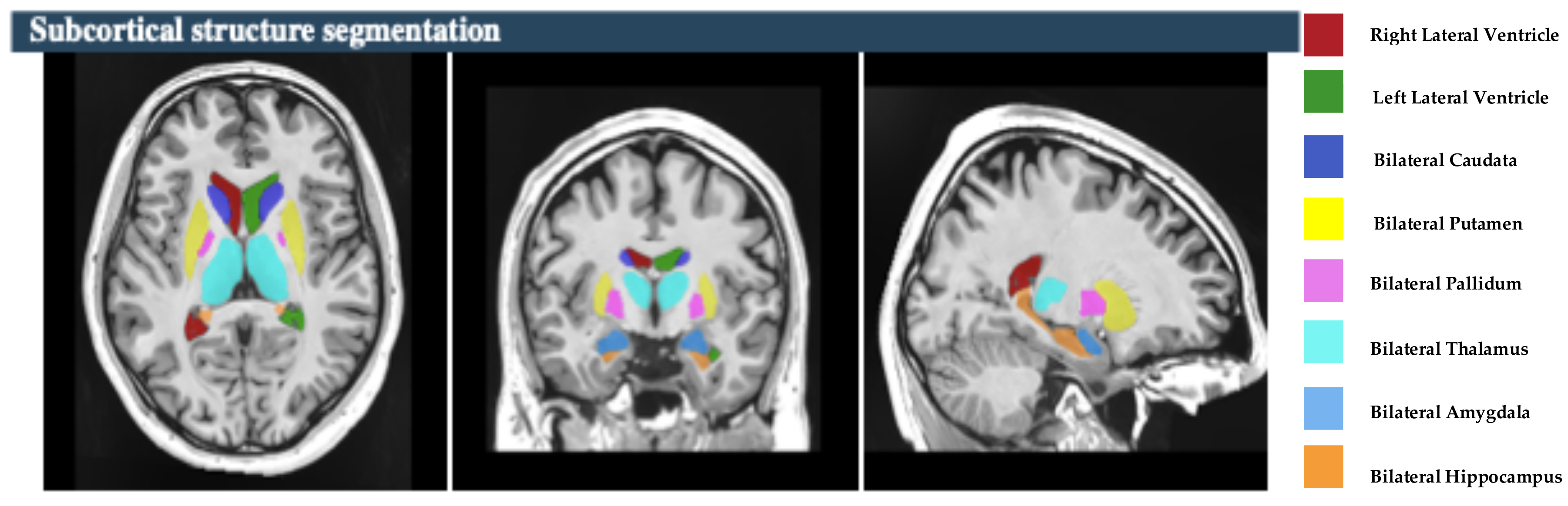 Brainsci 15 00295 g002 Brainsci 15 00295 g002