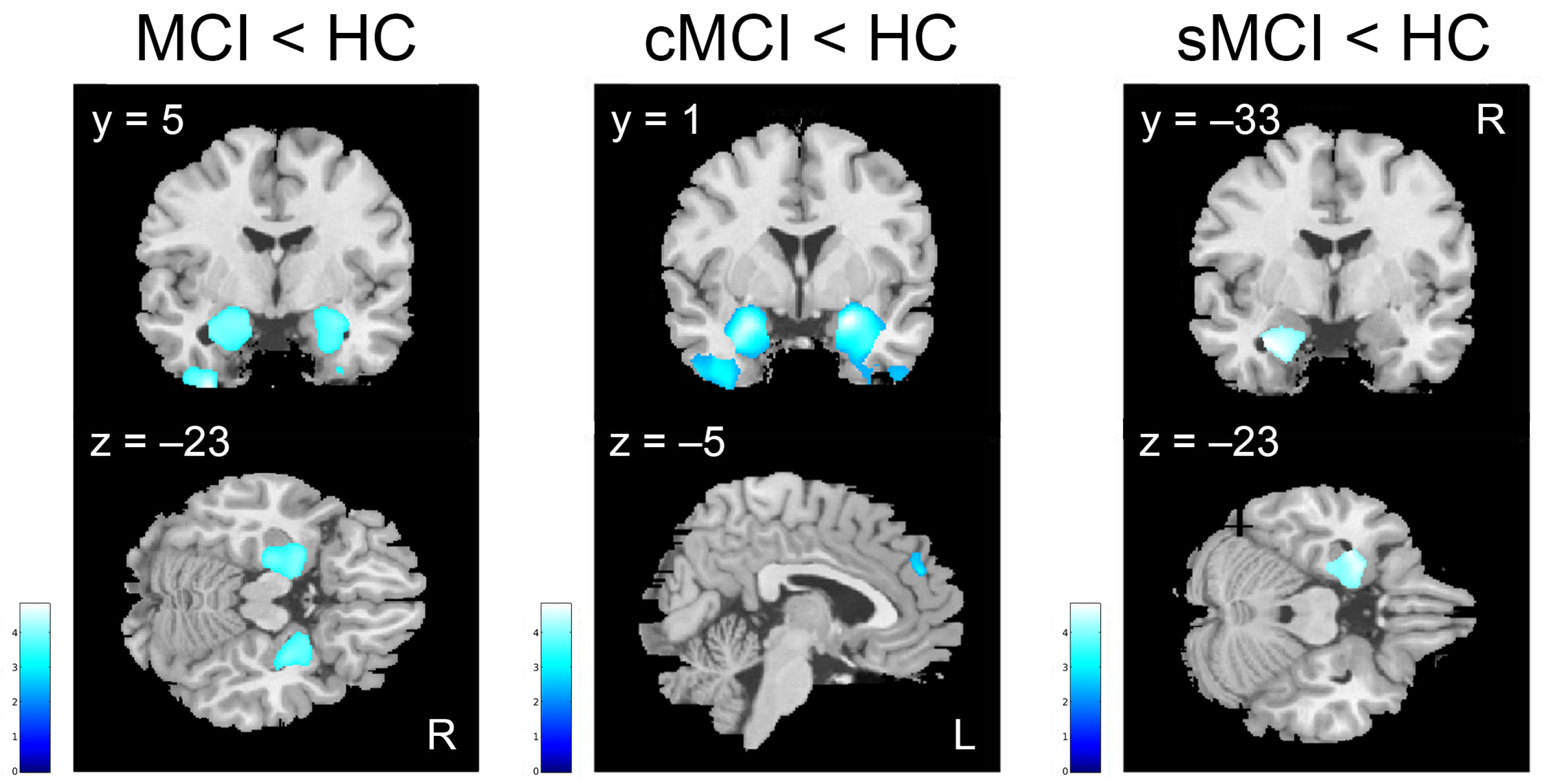 Brainsci 15 00310 g003