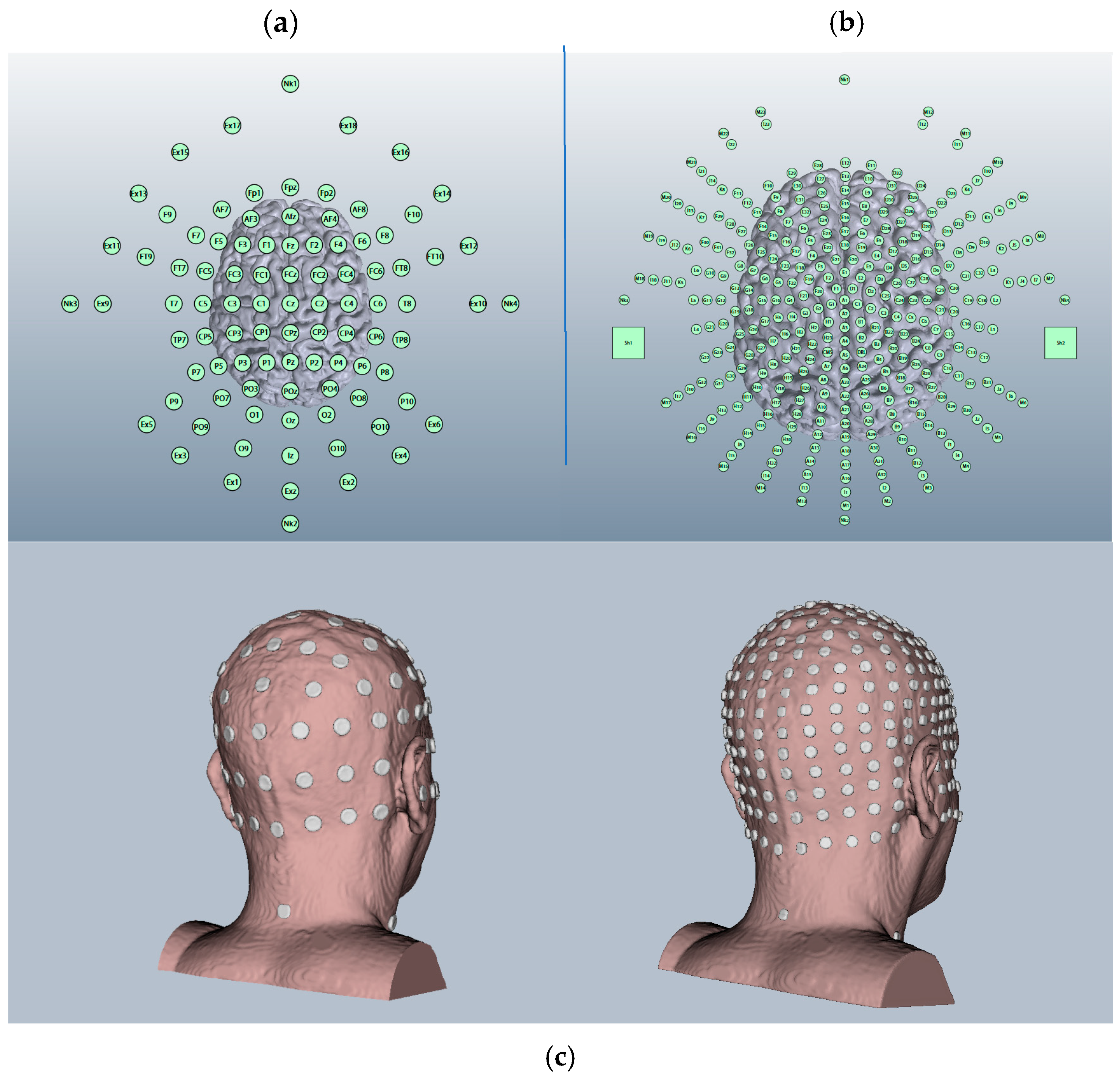 Brainsci 15 00344 g002