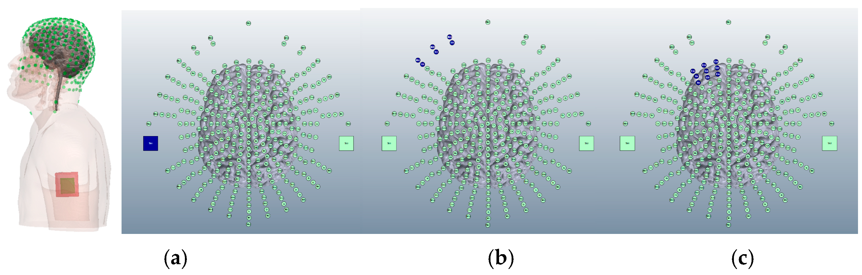 Brainsci 15 00344 g004