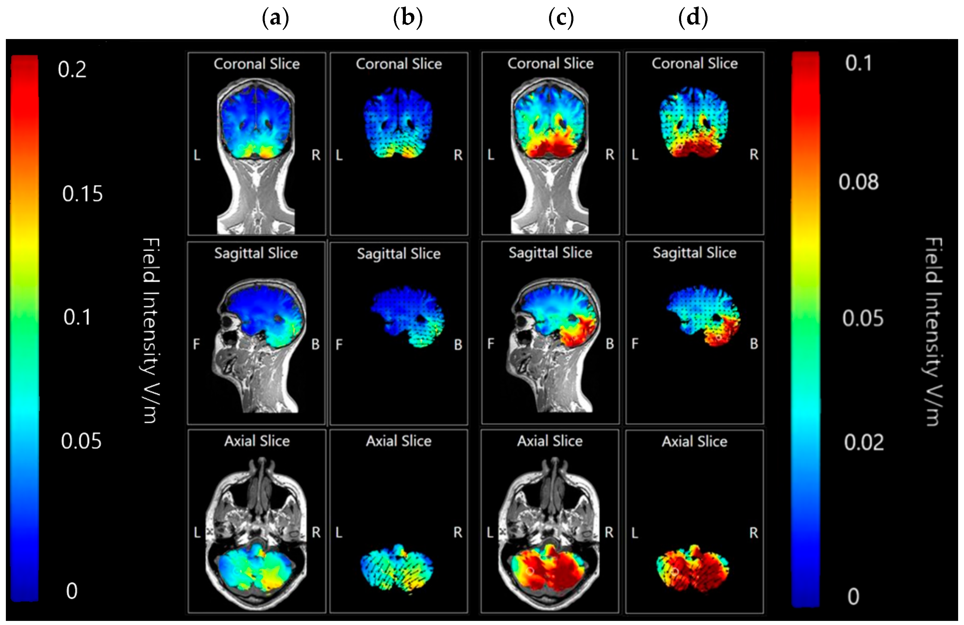 Brainsci 15 00344 g012