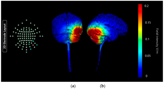 Brainsci 15 00344 g016