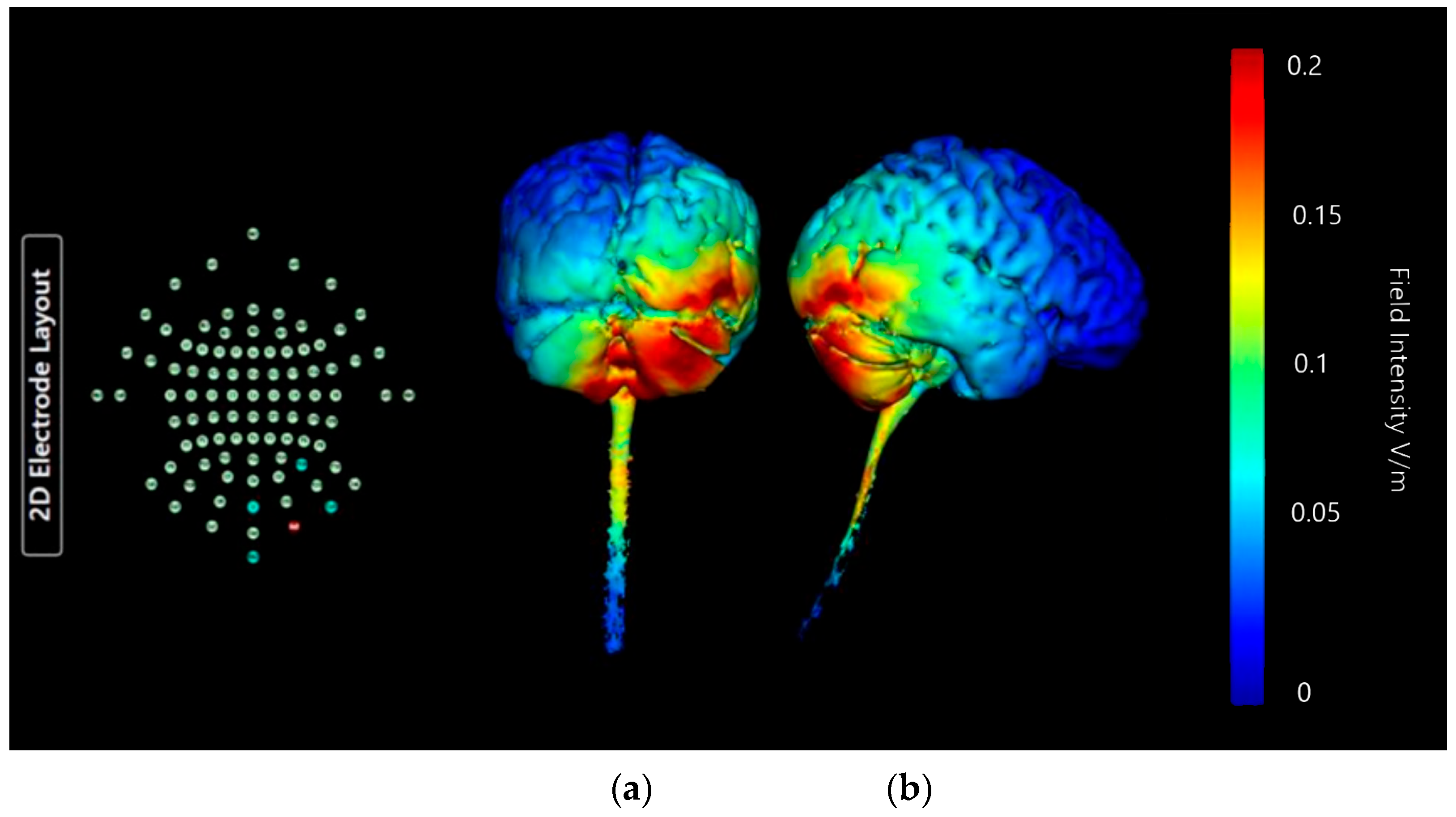 Brainsci 15 00344 g017