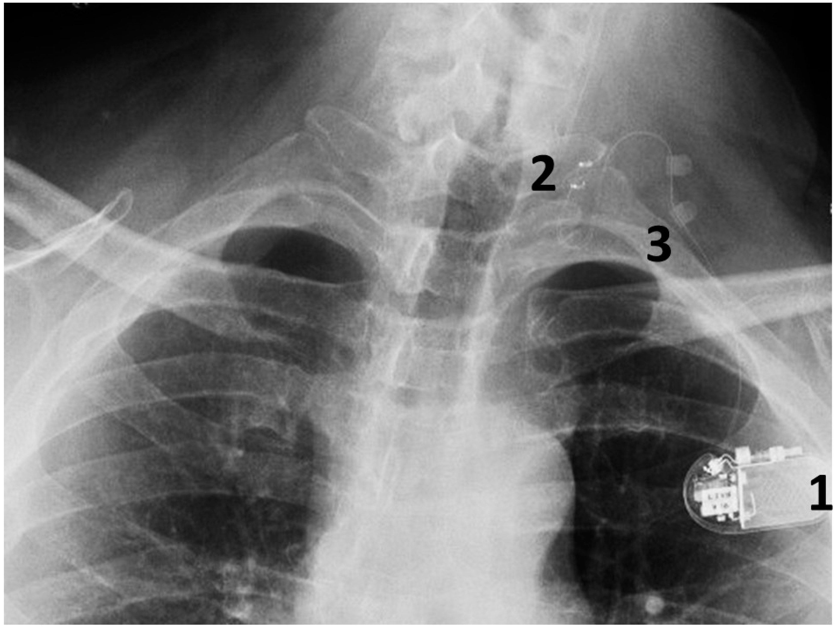 Brainsci 15 00346 g004