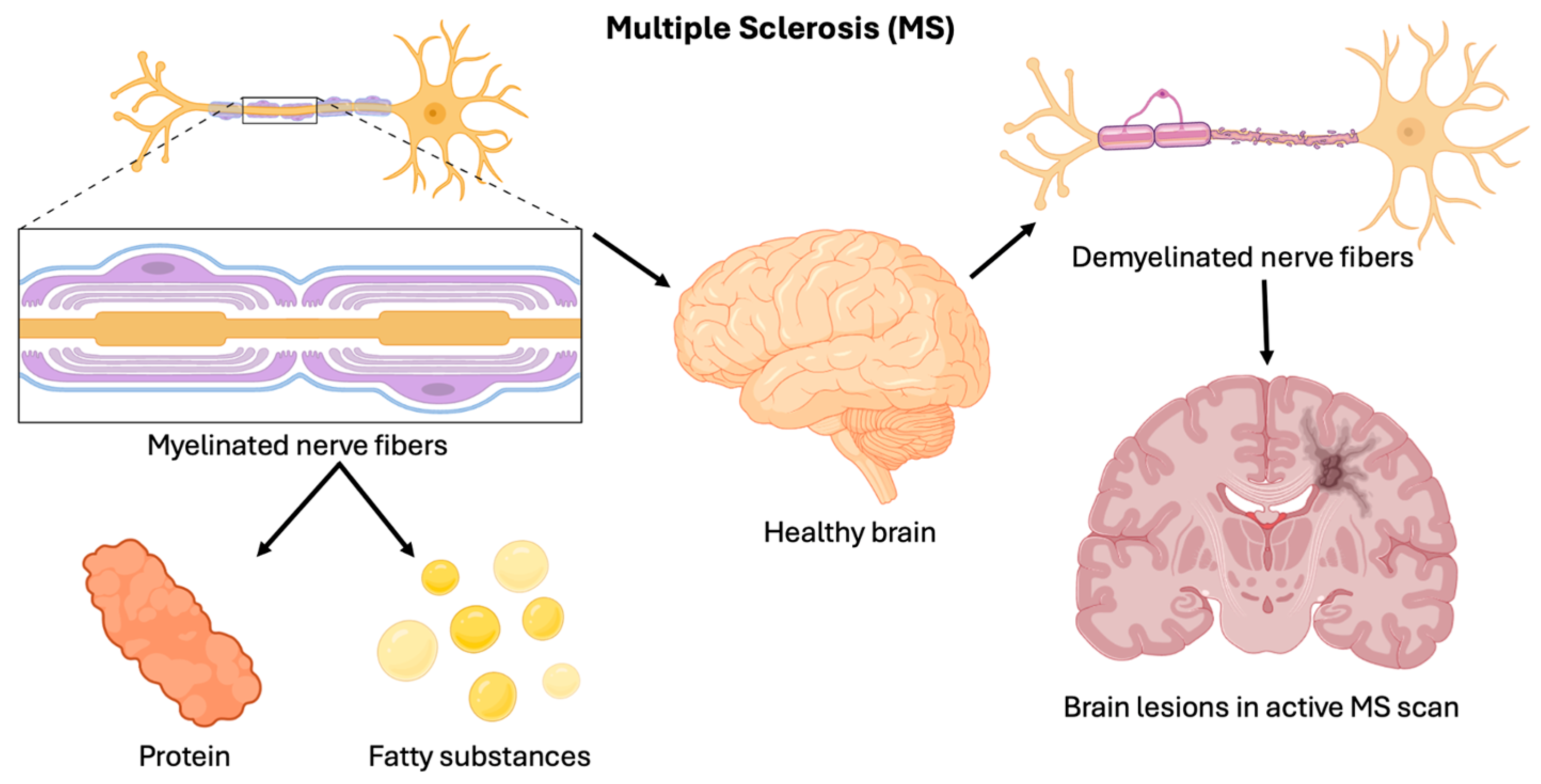 Brainsci 15 00436 g001 Brainsci 15 00436 g001