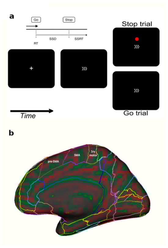 Brainsci 15 00448 g001