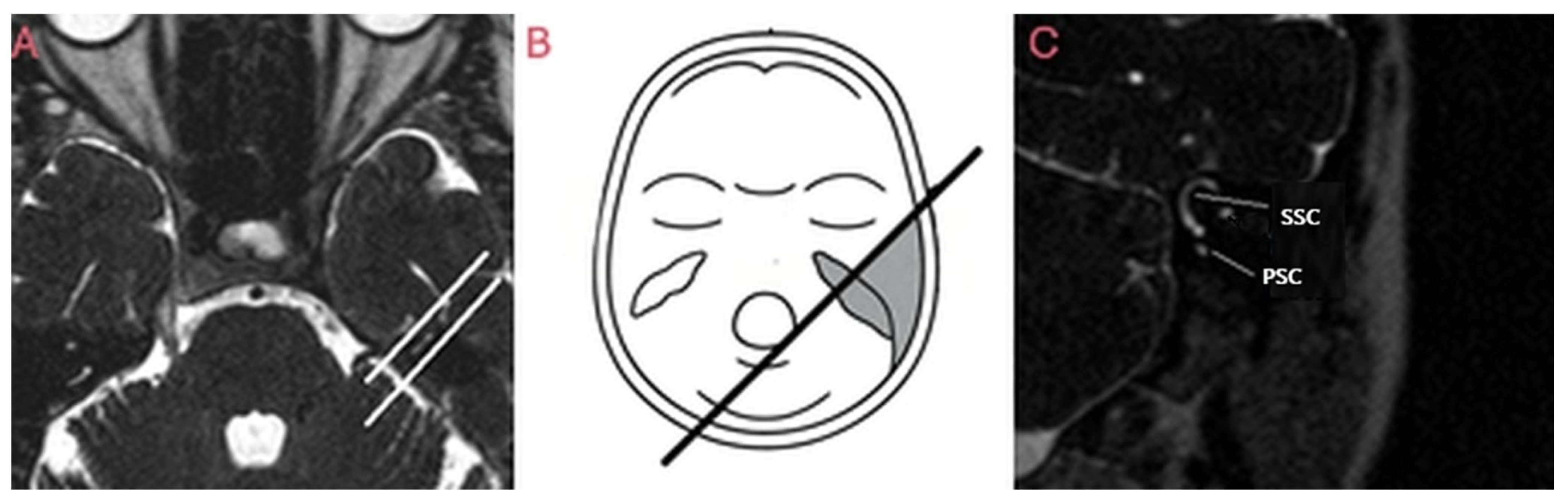 Brainsci 15 00555 g001 Brainsci 15 00555 g001