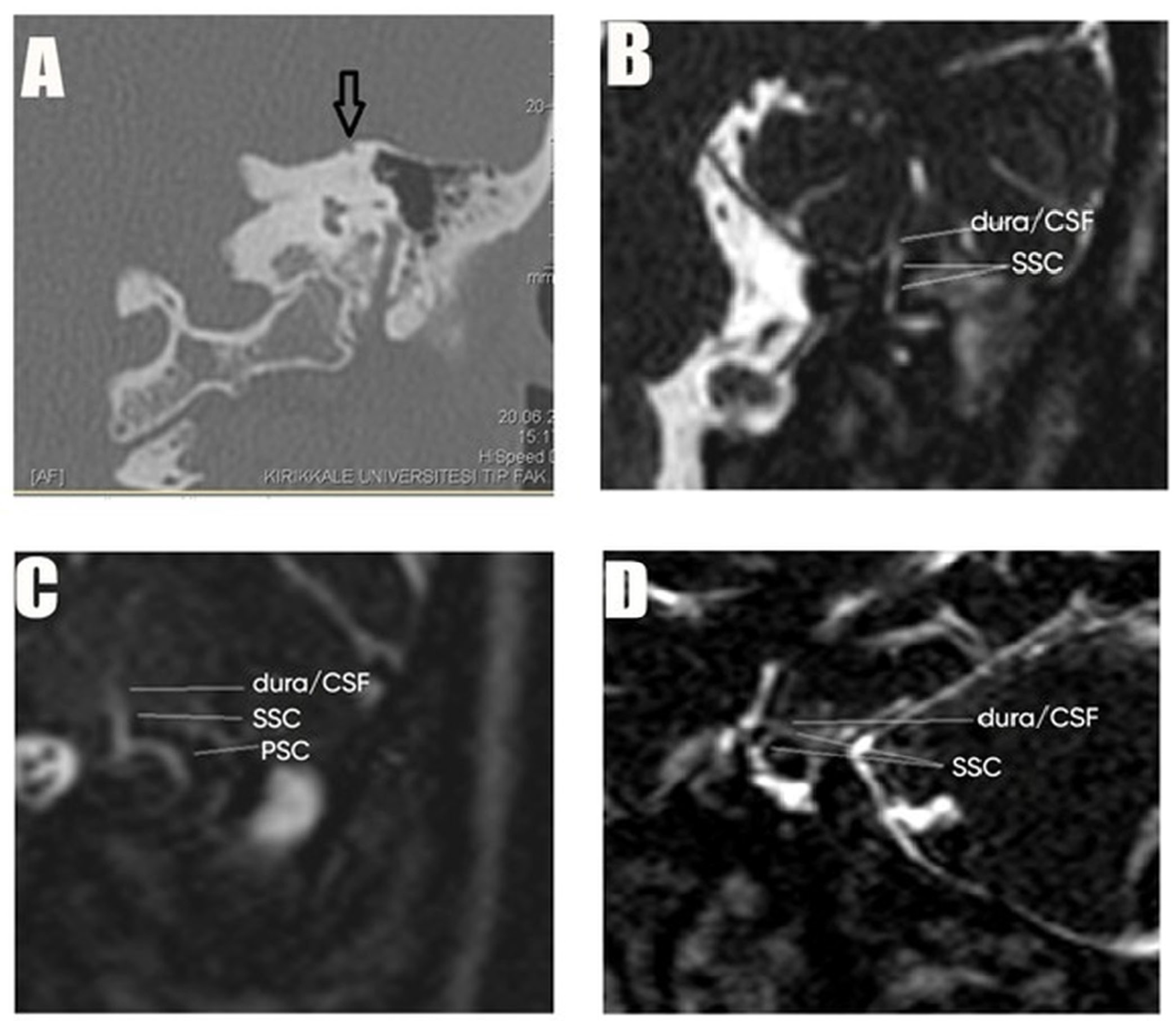 Brainsci 15 00555 g003 Brainsci 15 00555 g003