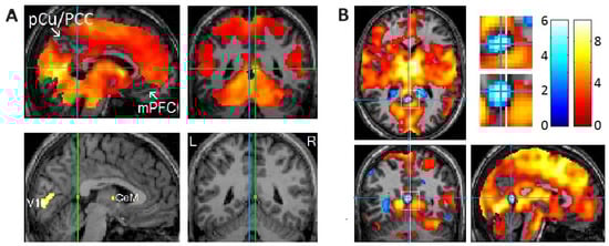 Brainsci 15 00574 g002