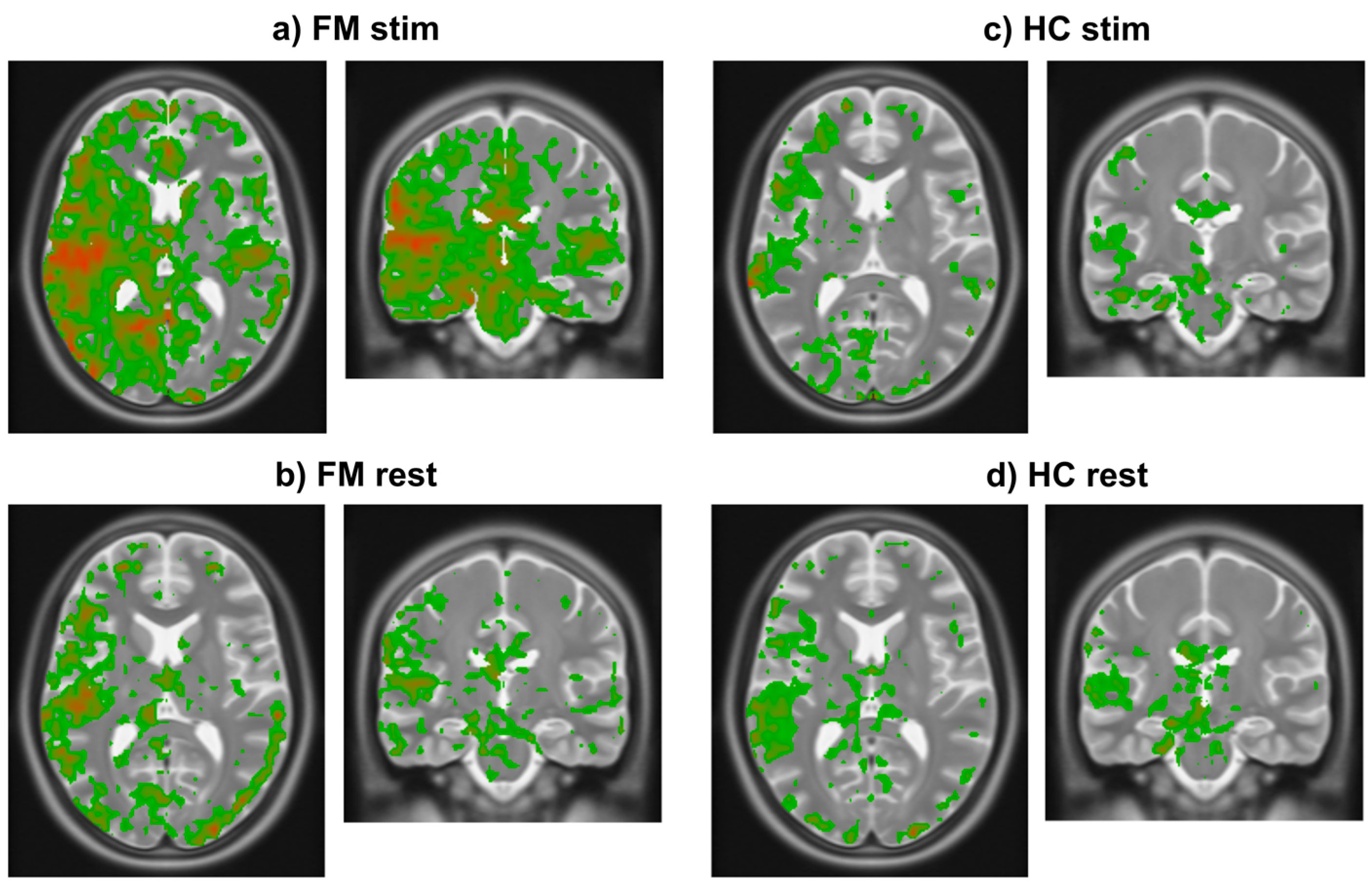 Brainsci 15 00603 g004