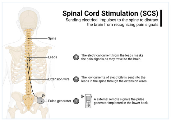 Brainsci 15 00616 g001