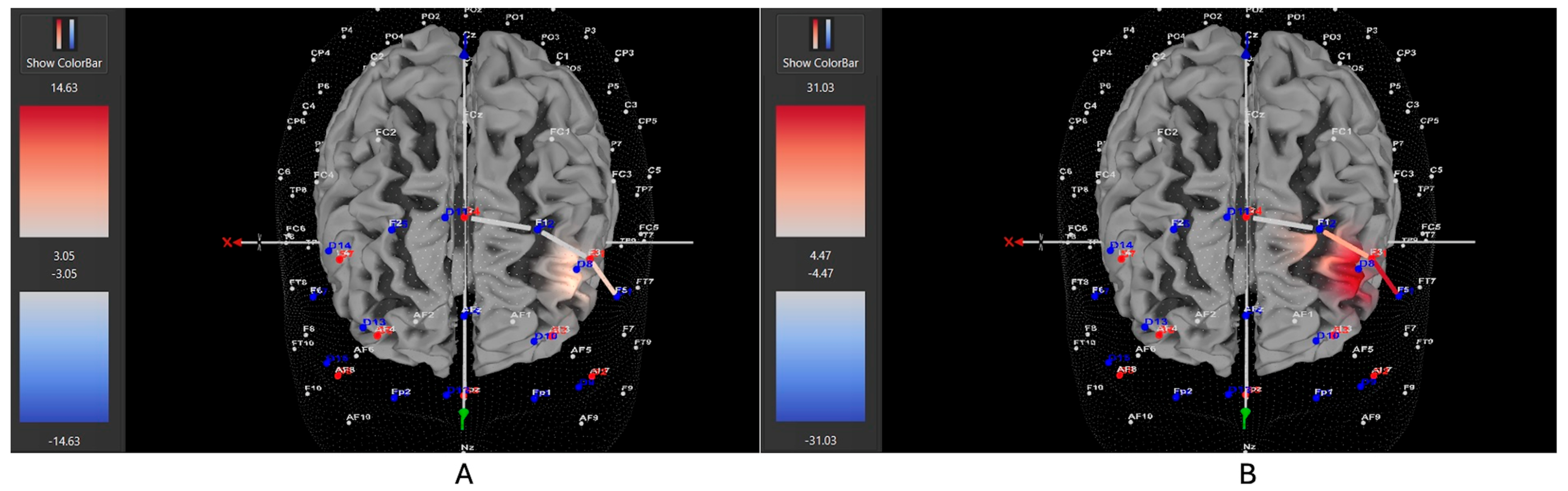 Brainsci 15 00623 g004