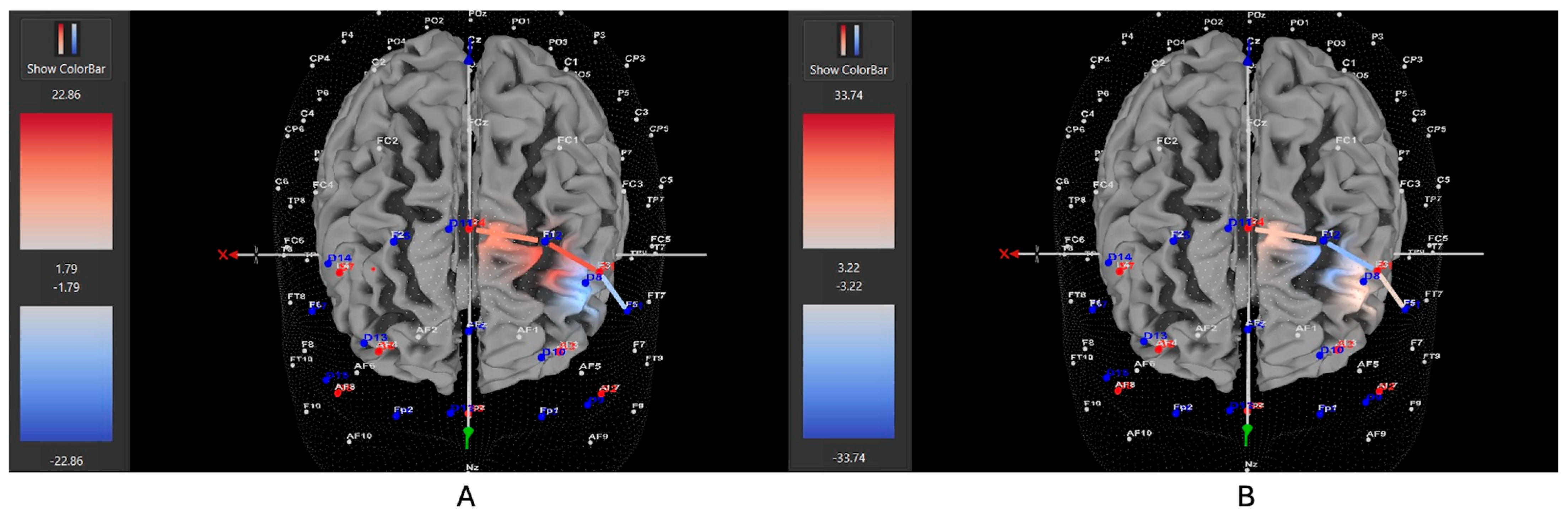 Brainsci 15 00623 g005