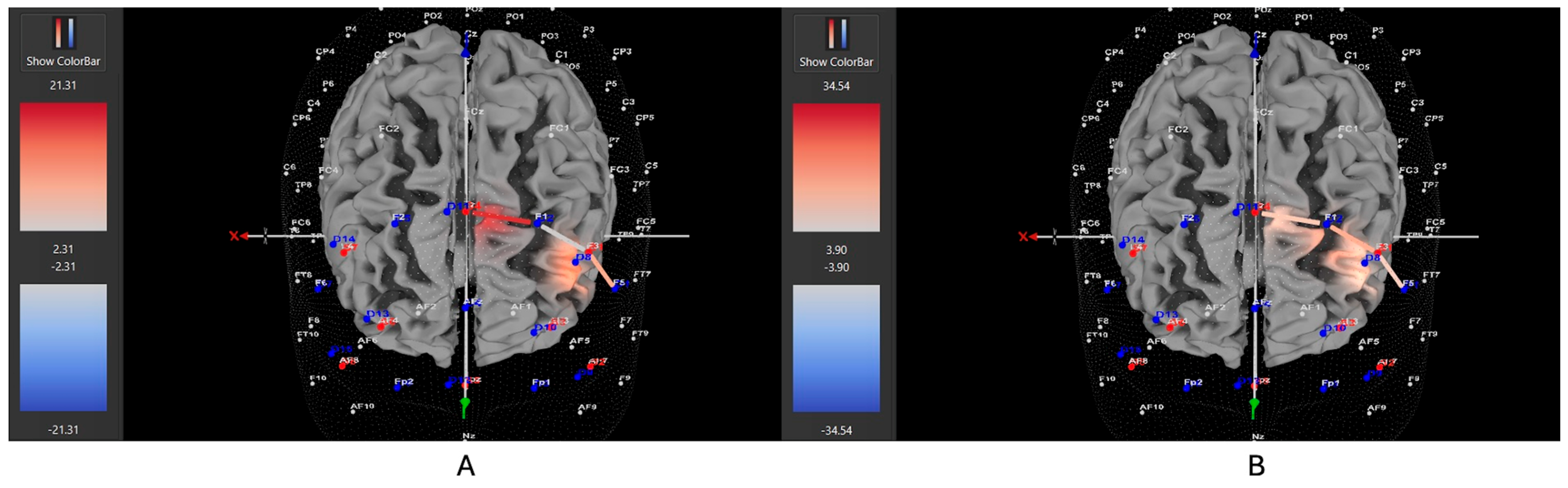 Brainsci 15 00623 g006