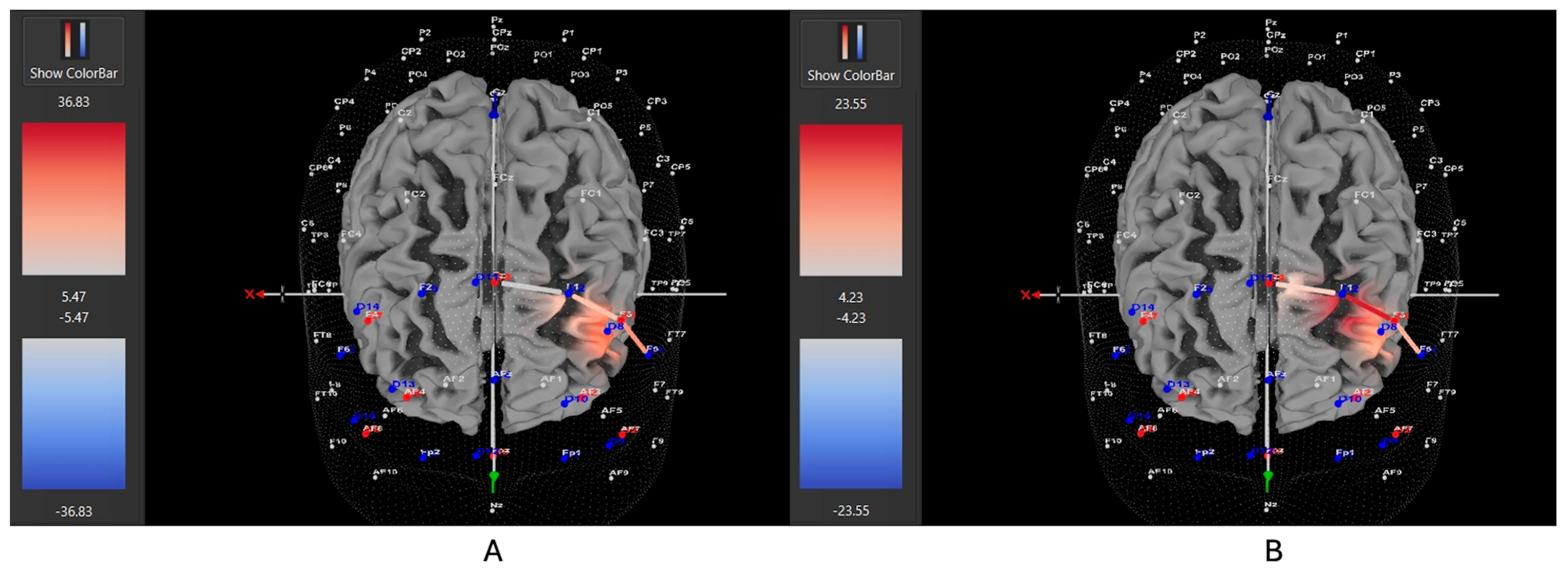 Brainsci 15 00623 g008