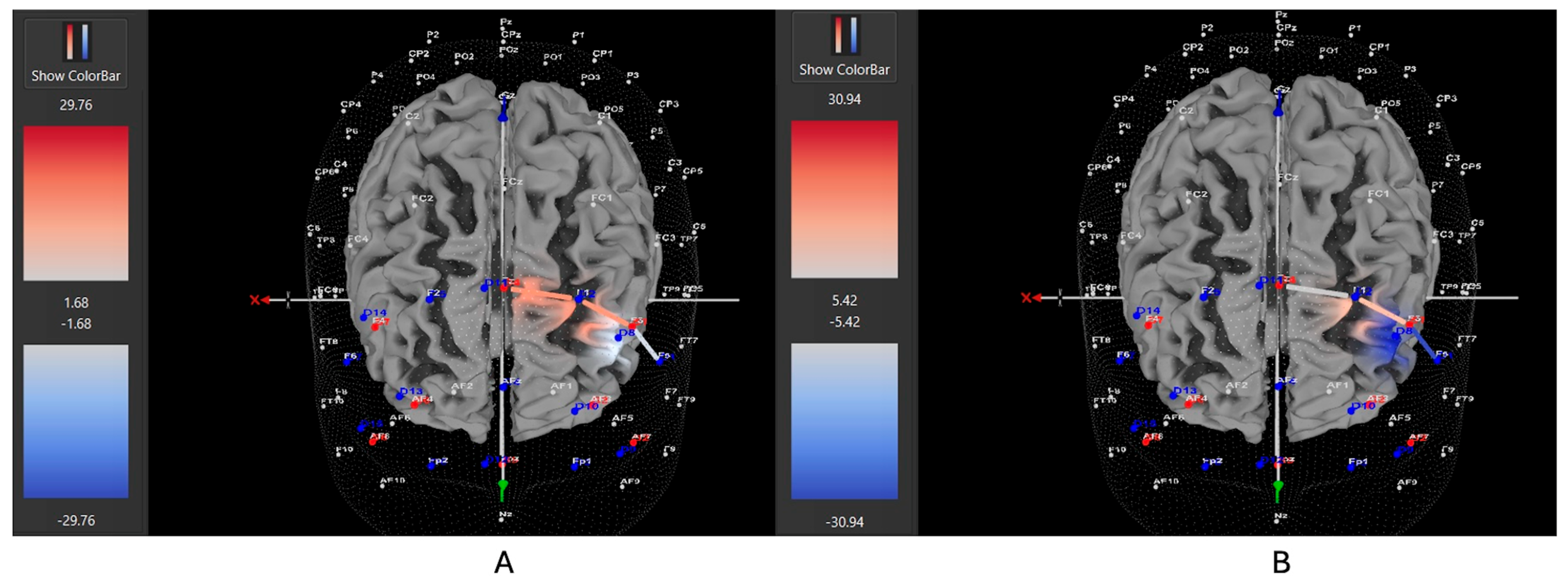 Brainsci 15 00623 g009