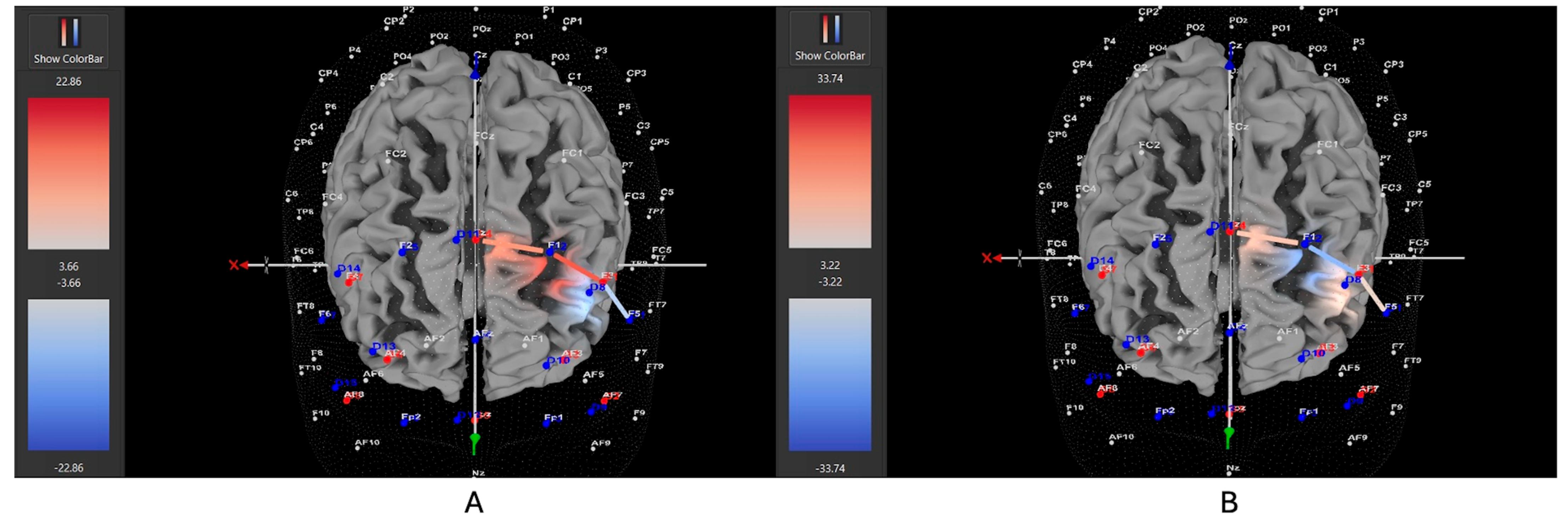 Brainsci 15 00623 g010