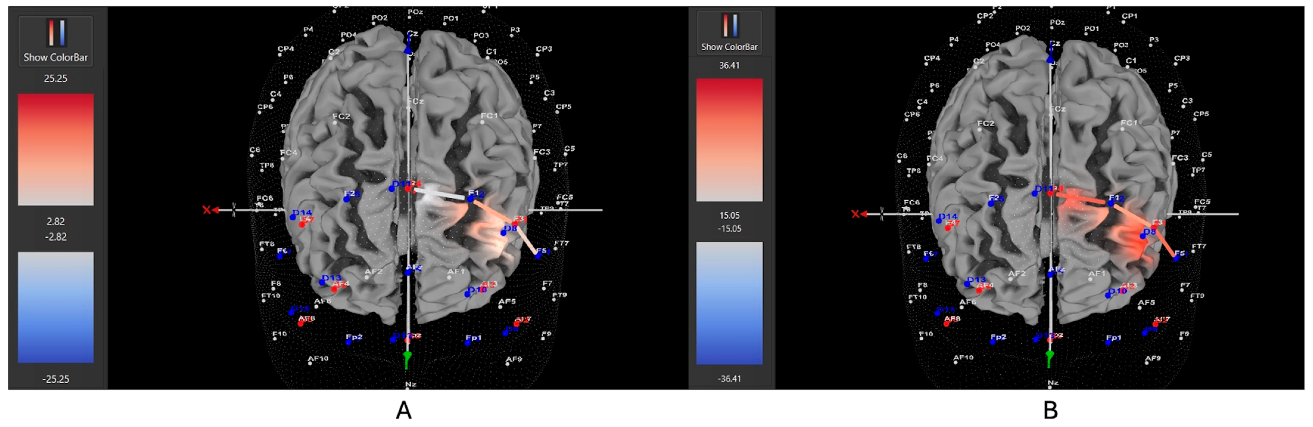 Brainsci 15 00623 g011