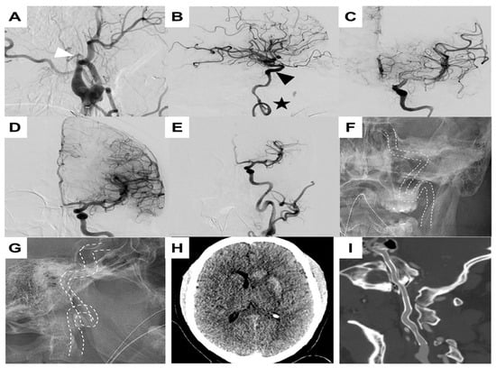 Brainsci 15 00629 g0a1