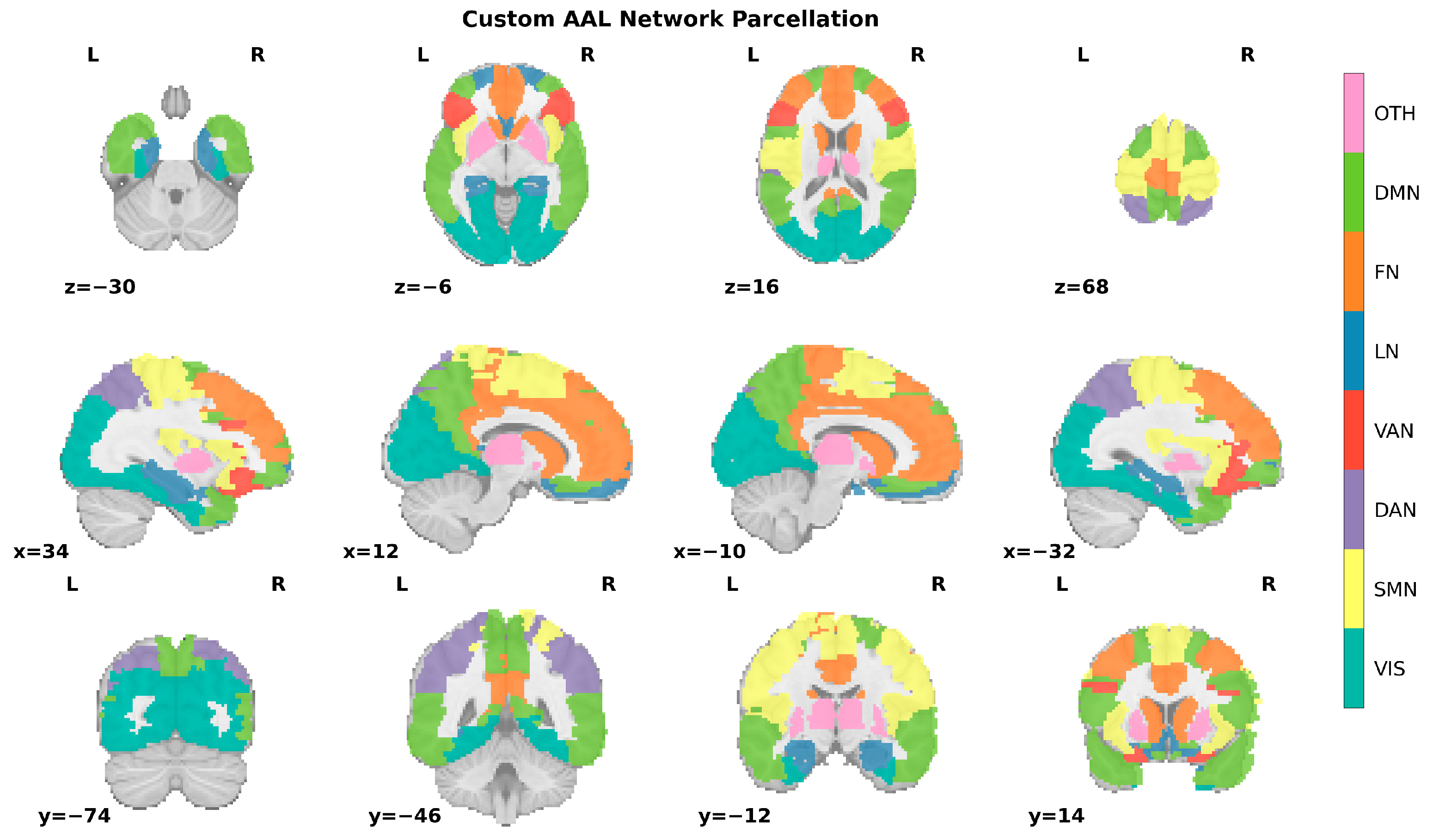 Brainsci 15 00636 g004