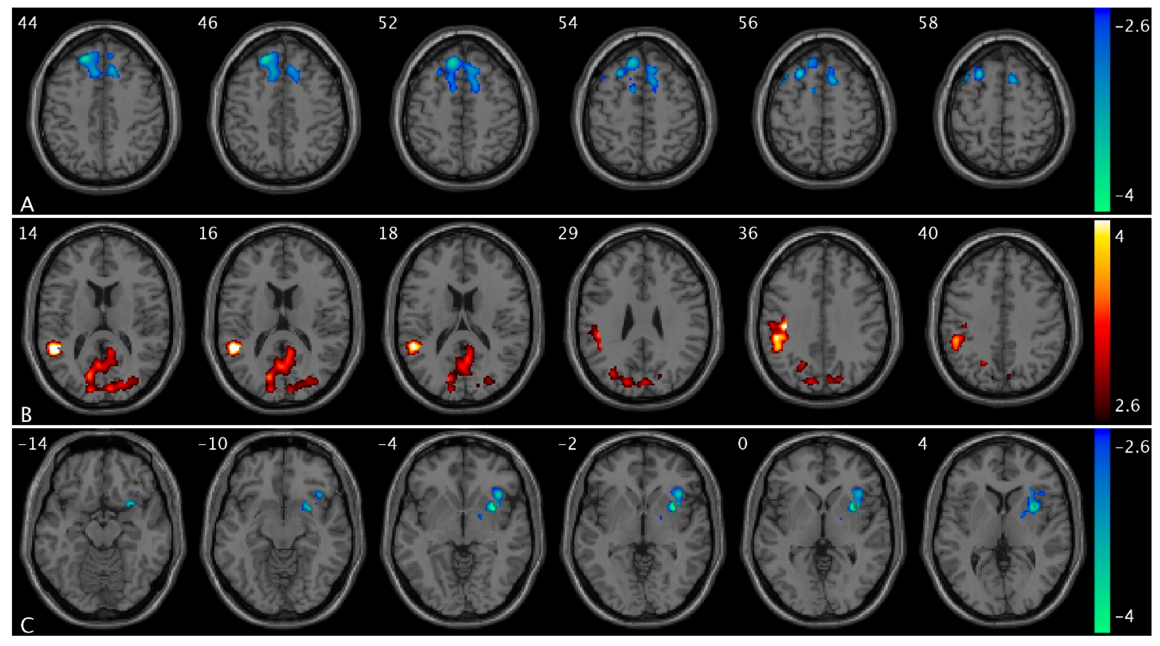 Brainsci 15 00689 g001 Brainsci 15 00689 g001