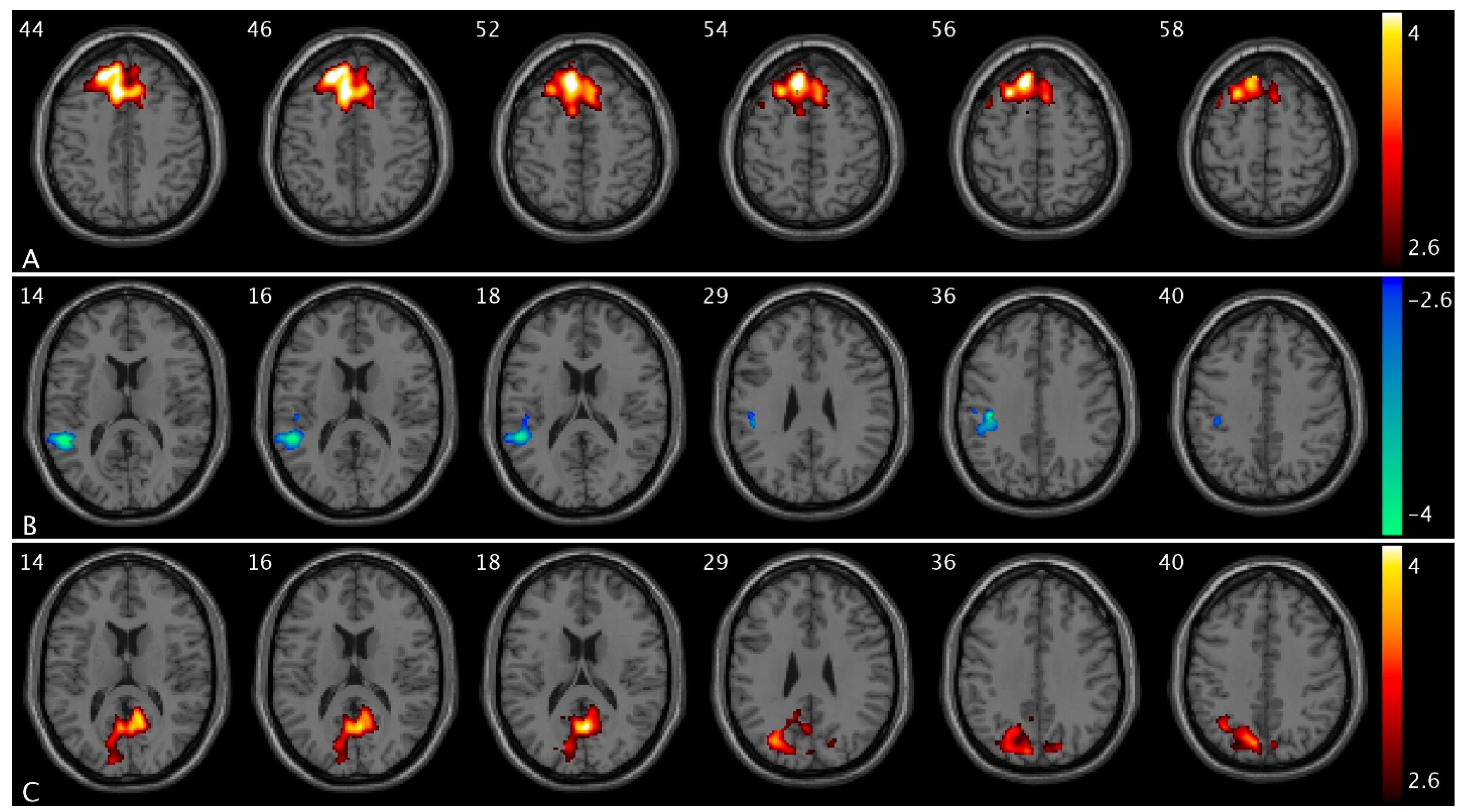 Brainsci 15 00689 g002 Brainsci 15 00689 g002