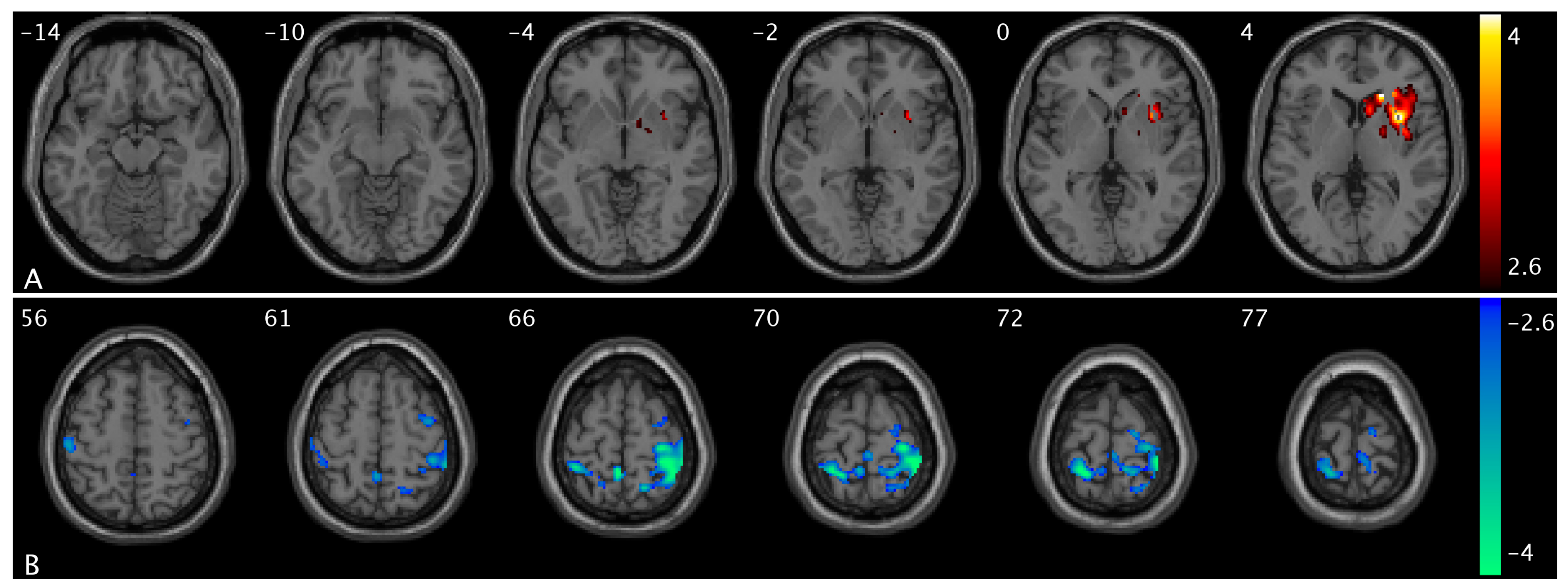 Brainsci 15 00689 g003 Brainsci 15 00689 g003