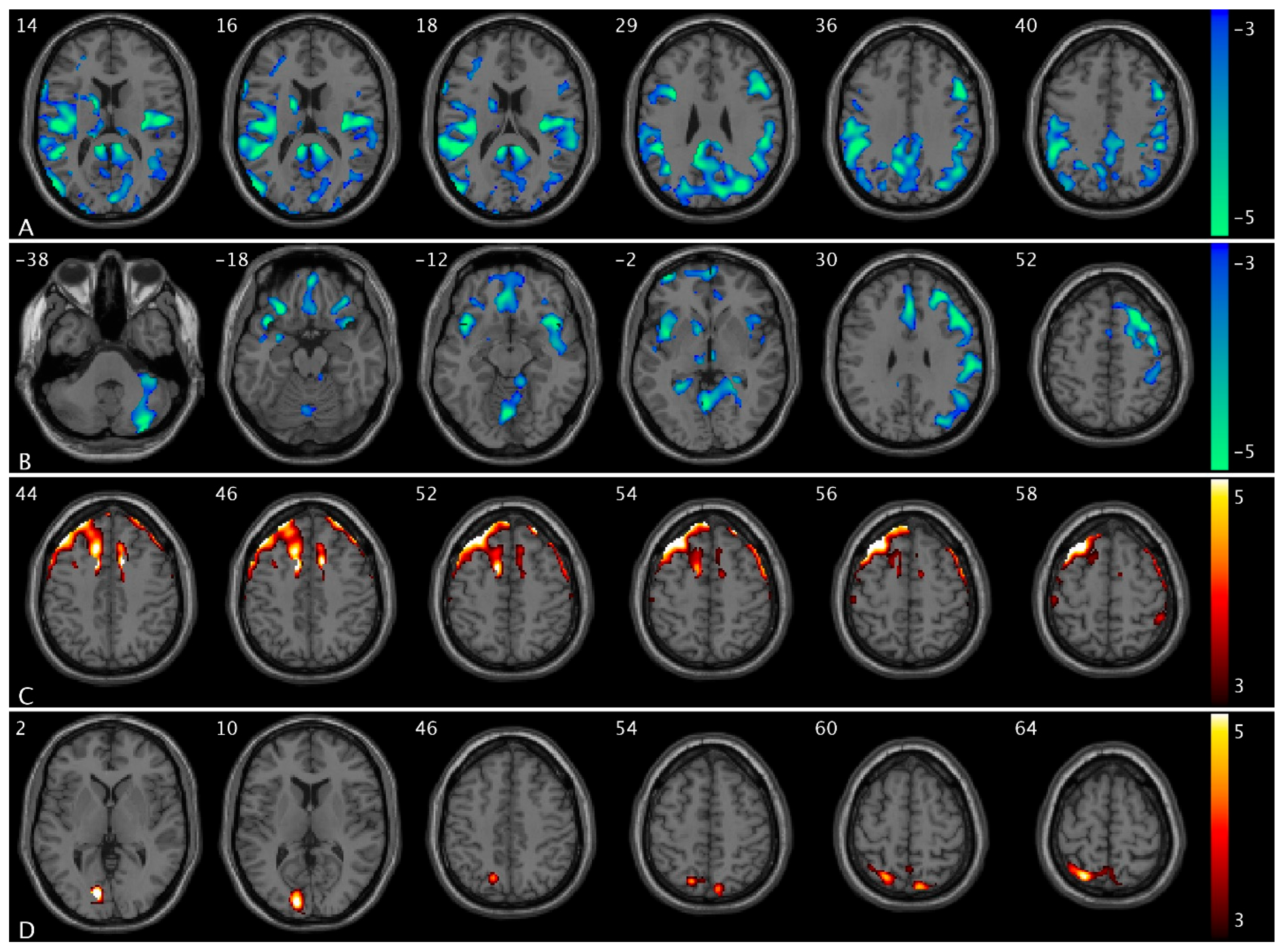 Brainsci 15 00689 g004 Brainsci 15 00689 g004