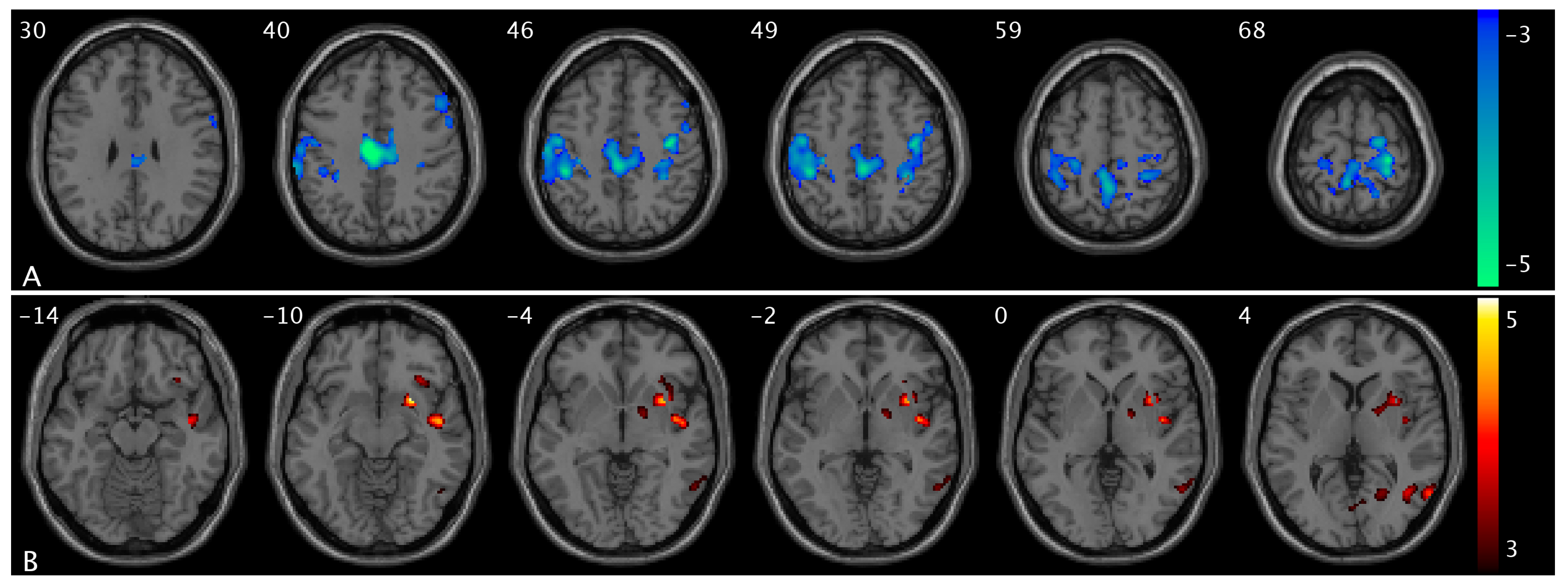Brainsci 15 00689 g005 Brainsci 15 00689 g005
