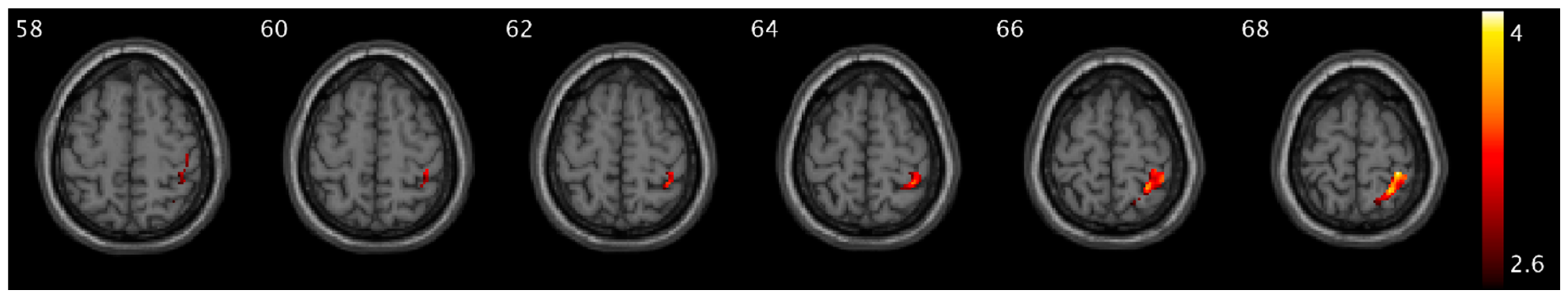 Brainsci 15 00689 g006 Brainsci 15 00689 g006