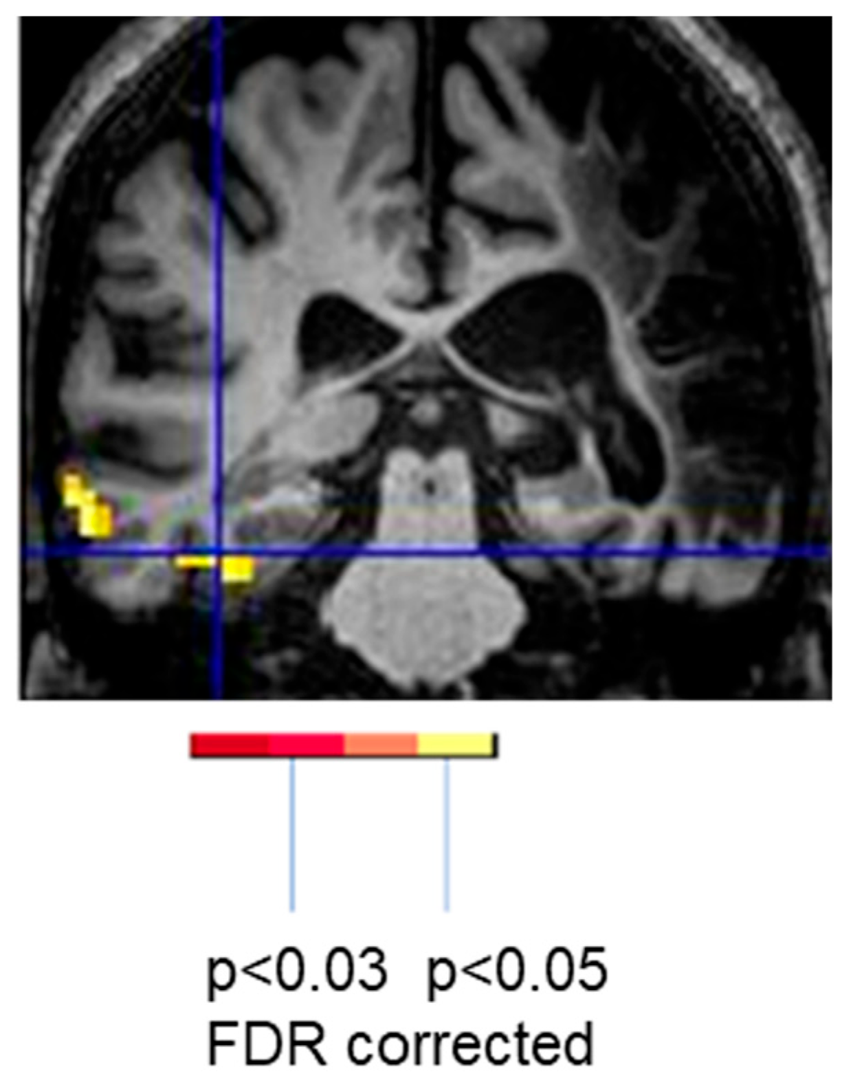 Brainsci 15 00790 g003