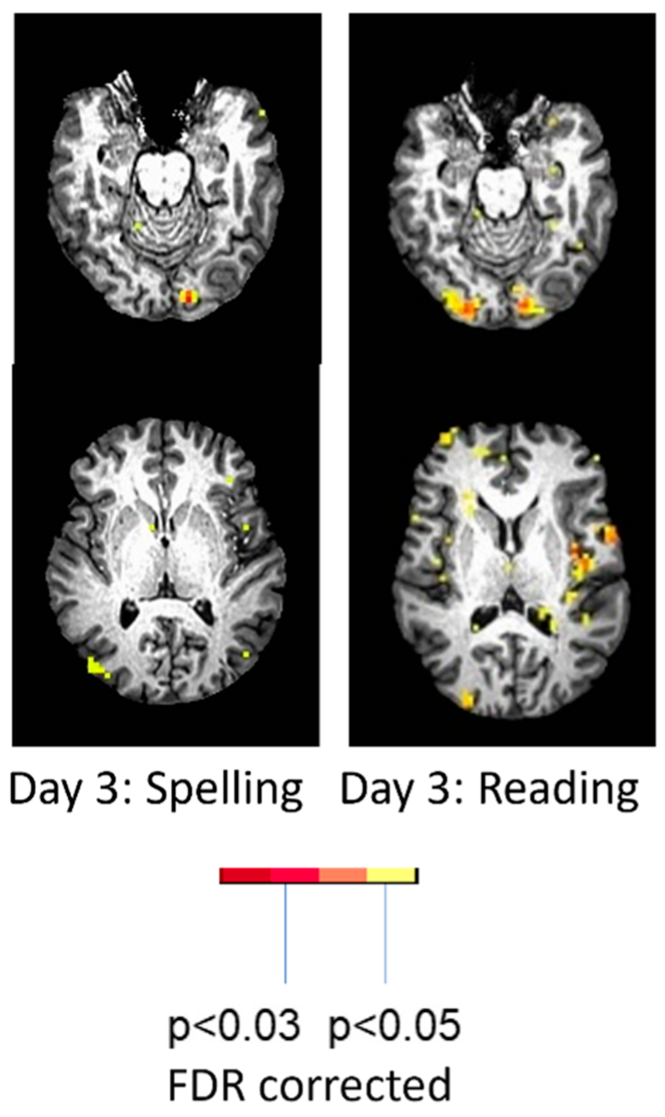 Brainsci 15 00790 g004