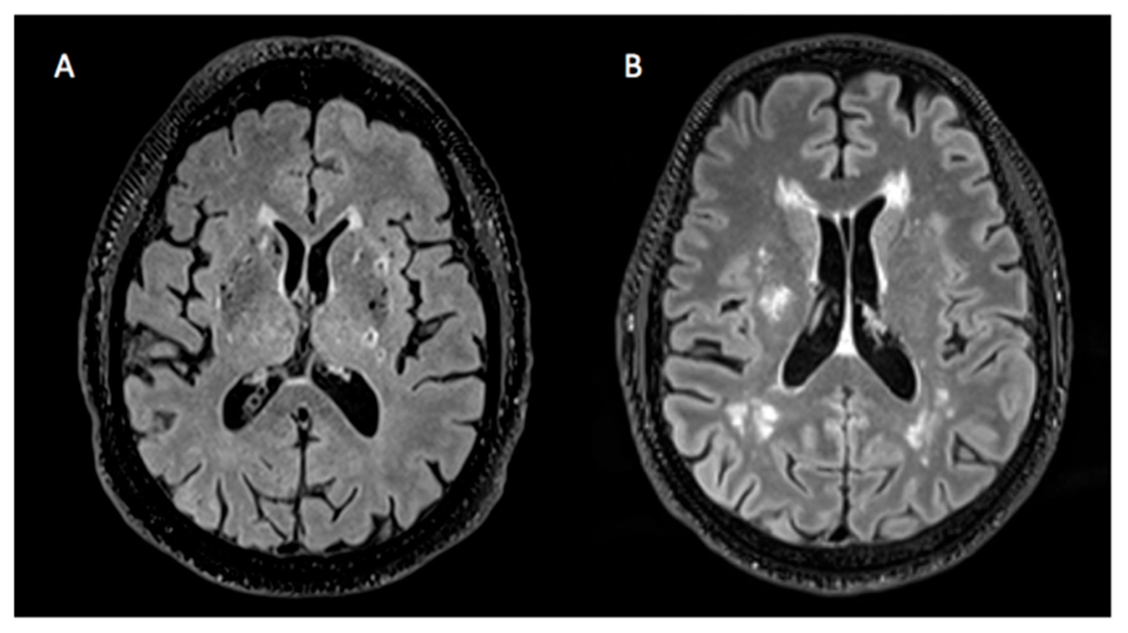 Brainsci 15 00804 g001 Brainsci 15 00804 g001