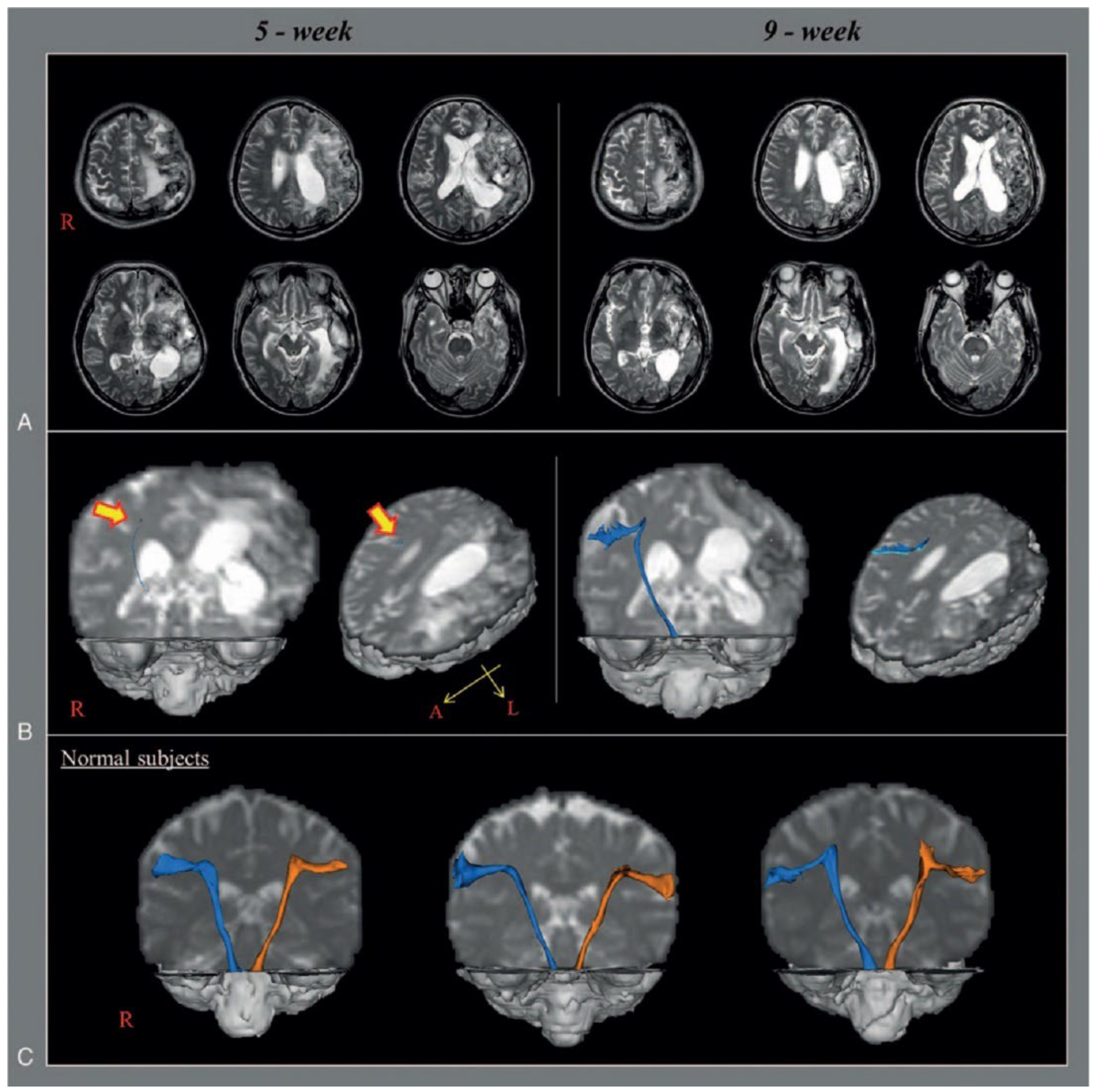 Brainsci 15 00925 g003