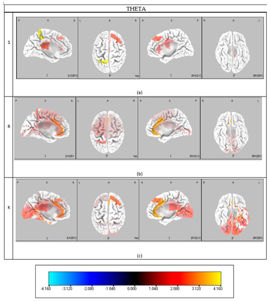 Brainsci 15 00981 g0a1