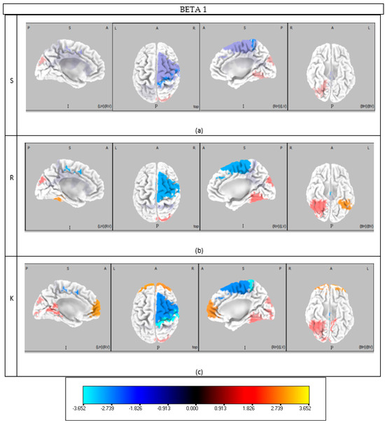 Brainsci 15 00981 g0a3