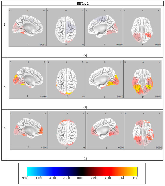 Brainsci 15 00981 g0a4