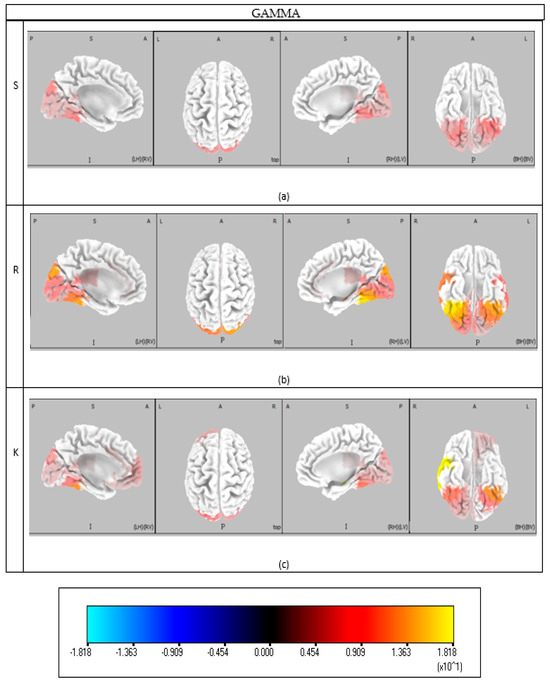 Brainsci 15 00981 g0a6