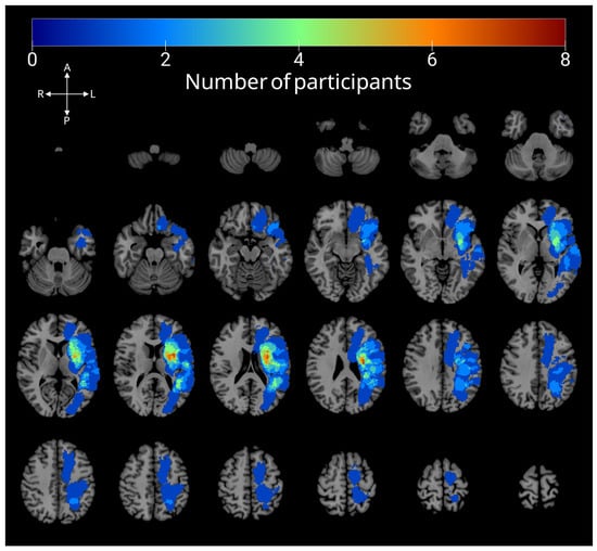 Brainsci 15 01039 g001