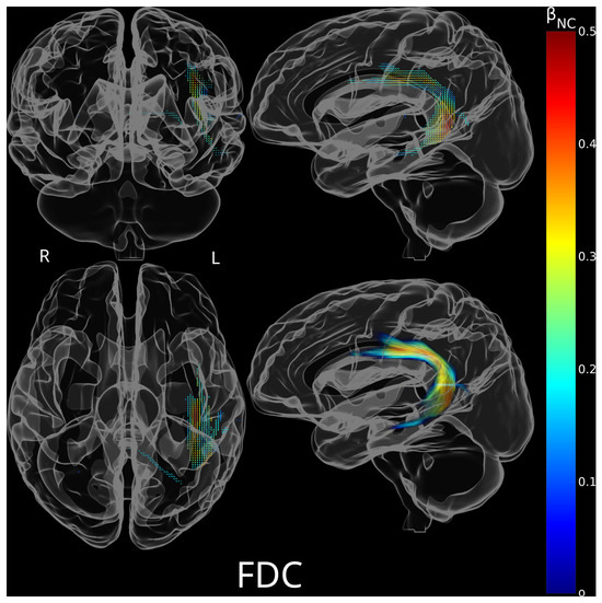 Brainsci 15 01039 g004