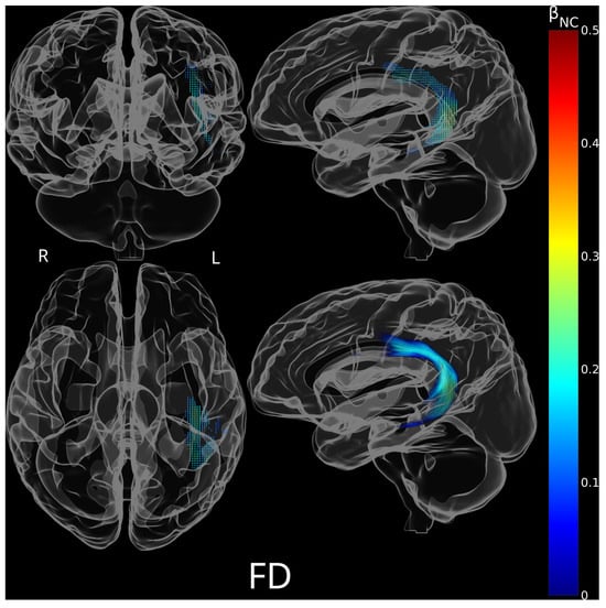 Brainsci 15 01039 g0a1