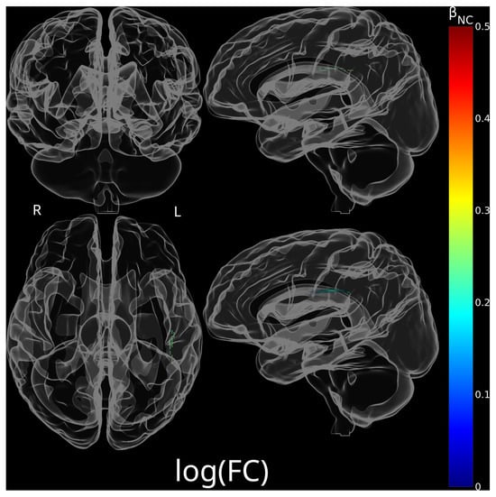 Brainsci 15 01039 g0a2