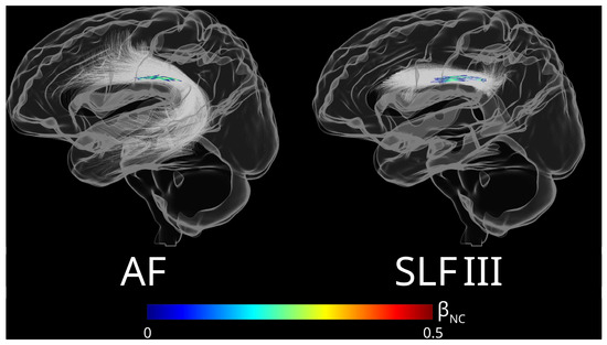 Brainsci 15 01039 g0a4