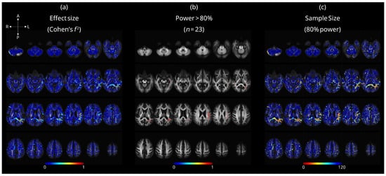 Brainsci 15 01039 g0a6