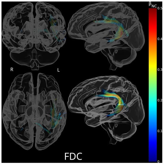 Brainsci 15 01039 g0a7