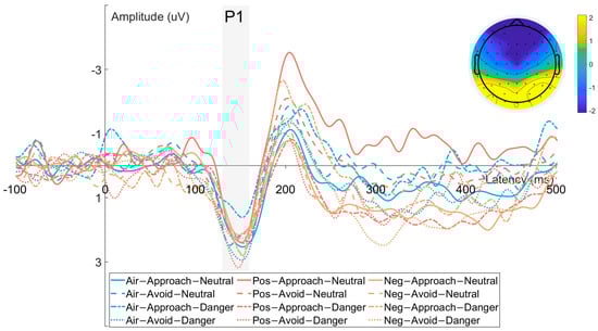 Brainsci 15 01041 g005