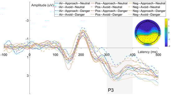 Brainsci 15 01041 g006