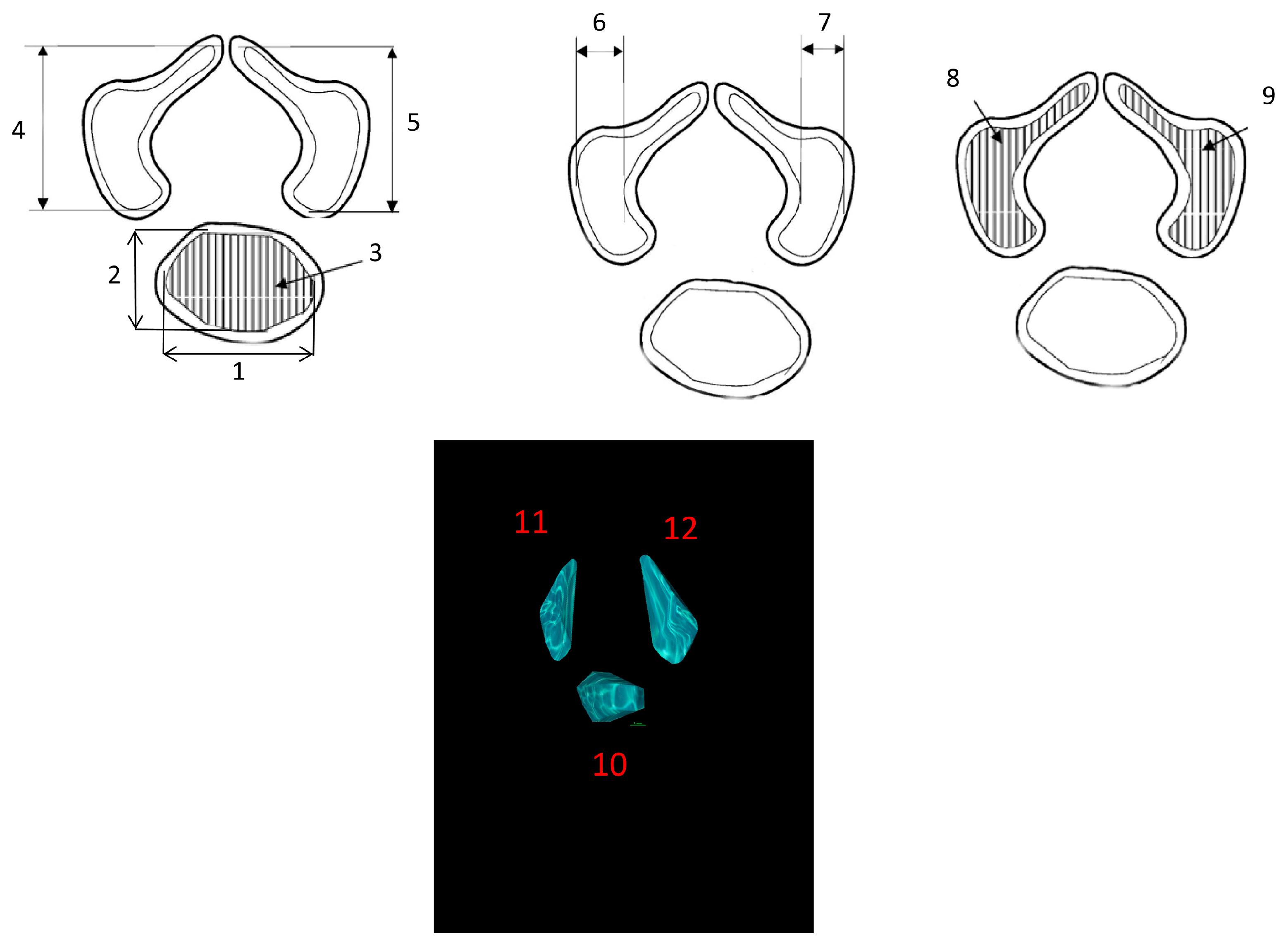 Brainsci 15 01138 g002 Brainsci 15 01138 g002