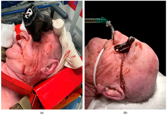 Brainsci 15 01160 g001