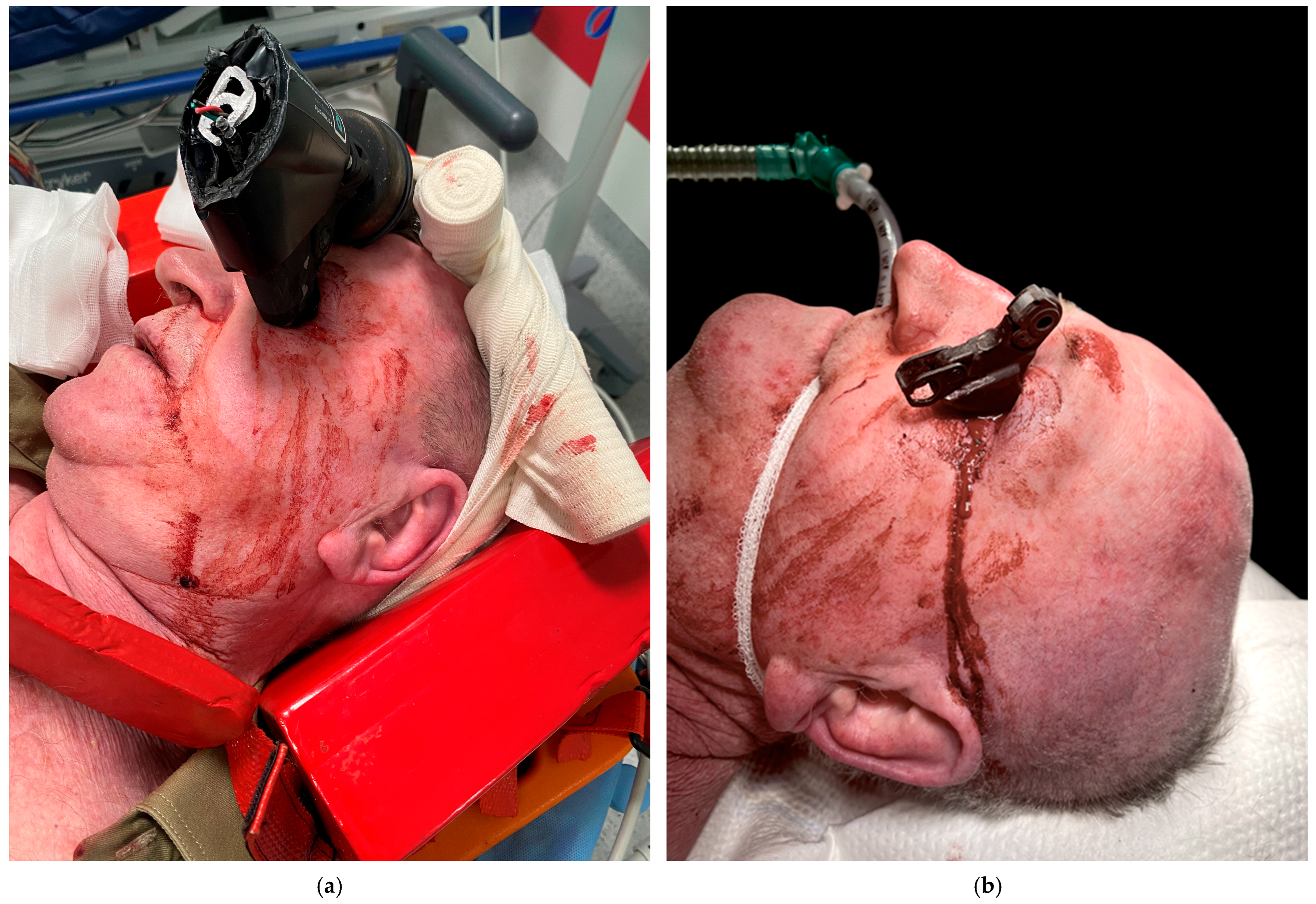 Brainsci 15 01160 g001 Brainsci 15 01160 g001